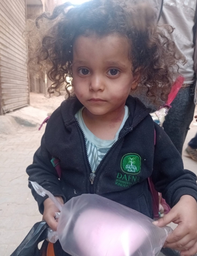 الطفلة وعليها أثار الجروح